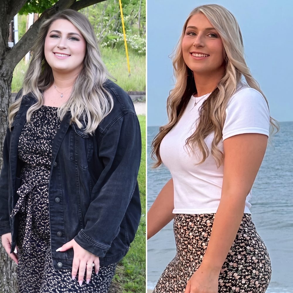 Ashley, 31 before and after GLP-1 weight loss