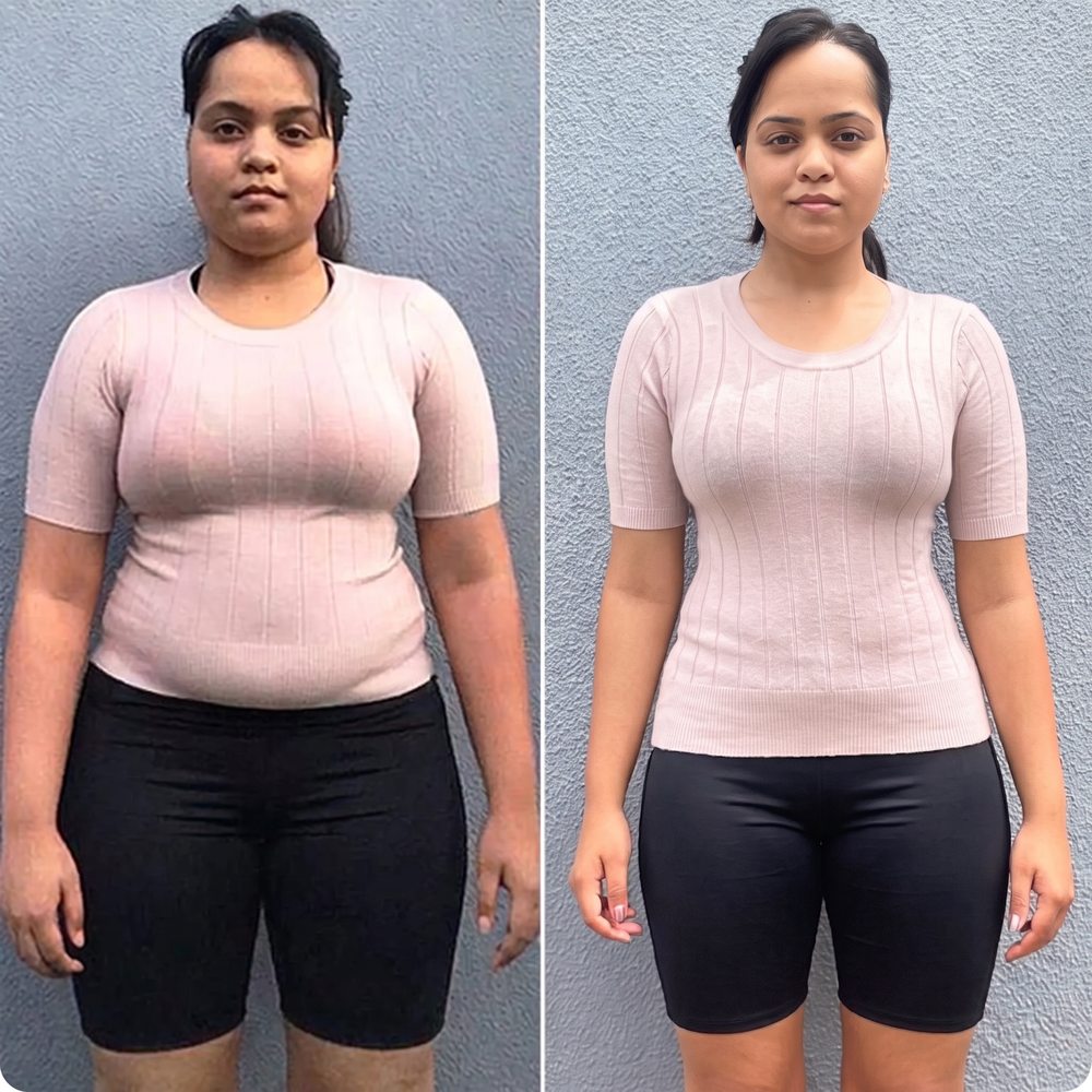 Priya, 34 before and after GLP-1 weight loss